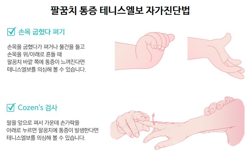 테니스엘보 자가진단법.png